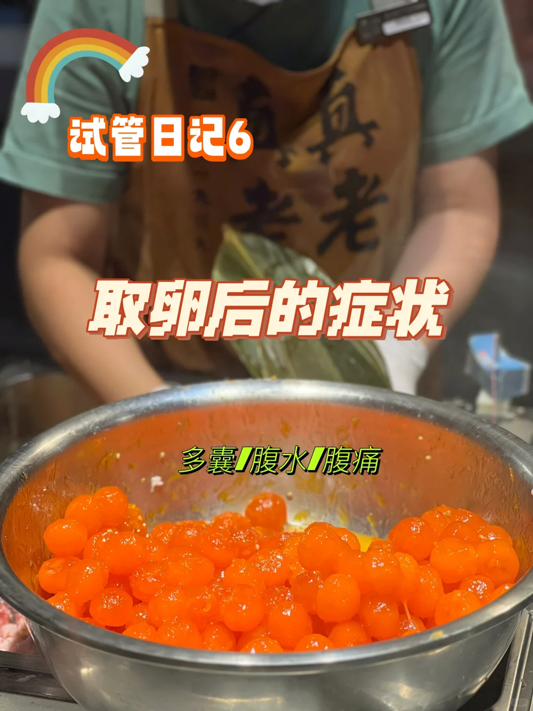 我取卵后的症状参考,国内代生费用排名-代孕公司代孕可有龄限制
